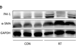 Establishment and confirmation of radiation-induced lung fibrosis in a murine model. (GAPDH 抗体)