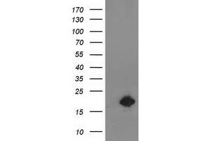 HEK293T cells were transfected with the pCMV6-ENTRY control (Left lane) or pCMV6-ENTRY DSTN (Right lane) cDNA for 48 hrs and lysed. (Destrin 抗体)