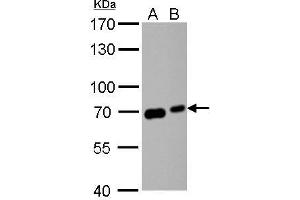 Western Blotting (WB) image for anti-Glutamate Decarboxylase 1 (Brain, 67kDa) (GAD1) (N-Term) antibody (ABIN2855214)