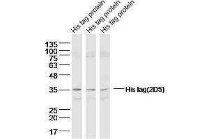 Lane 1-3: His Tagged protein lysates probed with His tag (2D5) Monoclonal Antibody  at 1:300 overnight at 4˚C. (His Tag 抗体)