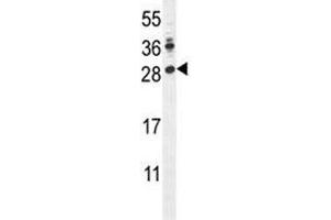 LIN28A antibody western blot analysis in mouse Neuro-2a lysate. (LIN28A 抗体  (AA 108-138))