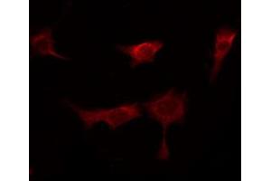 ABIN6267280 staining Hela by IF/ICC. (RAF1 抗体  (pSer296))