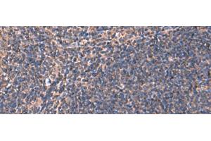 Immunohistochemistry of paraffin-embedded Human tonsil tissue using RHAG Polyclonal Antibody at dilution of 1:130(x200) (RHAG 抗体)