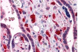 Human Placenta: Formalin-Fixed, Paraffin-Embedded (FFPE) (SMAD6 抗体  (AA 285-385))