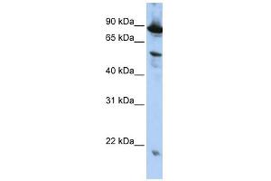 Western Blotting (WB) image for anti-Zinc Finger, CCCH-Type with G Patch Domain (ZGPAT) (N-Term) antibody (ABIN632082)
