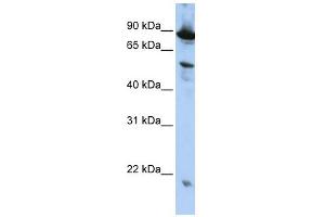 ZGPAT antibody used at 1 ug/ml to detect target protein.
