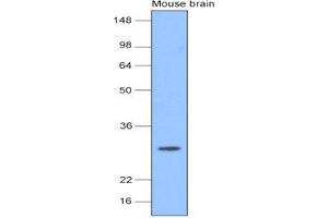 Western Blotting (WB) image for anti-Ubiquitin Carboxyl-terminal Esterase L1 (Ubiquitin Thiolesterase) (UCHL1) (AA 1-223) antibody (ABIN377235) (UCHL1 抗体  (AA 1-223))