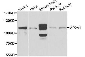 Western blot analysis of extracts of various cell lines, using AP2A1 antibody. (alpha Adaptin 抗体  (AA 1-260))