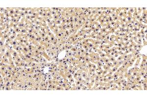 Detection of AST in Mouse Liver Tissue using Monoclonal Antibody to Aspartate Aminotransferase (AST) (GOT1 抗体  (AA 1-413))