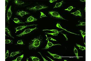 Immunofluorescence (IF) image for anti-TNF Receptor-Associated Protein 1 (TRAP1) (AA 1-704) antibody (ABIN950060)