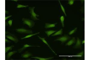 Immunofluorescence of purified MaxPab antibody to MDM4 on HeLa cell. (MDM4-binding Protein 抗体  (AA 1-490))