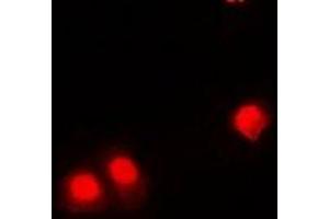 Immunofluorescent analysis of CHD4 staining in HEK293 cells. (CHD4 抗体)