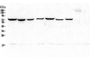 Western blot analysis of Hsp70 using anti-Hsp70 antibody (ABIN5693238).