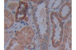 DAB staining on IHC-P; Samples: Human Kidney Tissue (Cadherin 4 抗体  (AA 667-916))