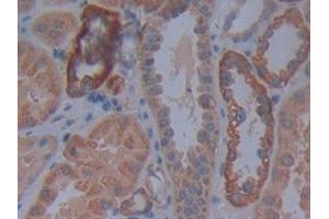 DAB staining on IHC-P; Samples: Human Kidney Tissue (Cadherin 4 抗体  (AA 667-916))