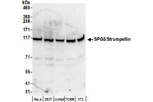 anti-WASH Complex Subunit 5 (WASHC5) (AA 1109-1159) antibody