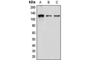 Western blot analysis of Atrophin-1 expression in K562 (A), EOC20 (B), HeLa (C) whole cell lysates. (Atrophin 1 抗体  (N-Term))