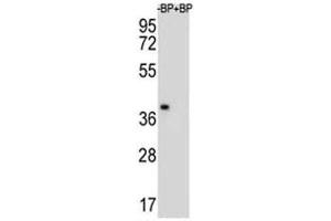 Western blot analysis of MBP antibody and NCI-H460 lysate. (MBP 抗体  (AA 177-209))