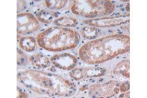 Used in DAB staining on fromalin fixed paraffin- embedded kidney tissue (FASTK 抗体  (AA 330-524))
