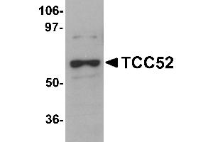 Western Blotting (WB) image for anti-DDB1 and CUL4 Associated Factor 12 (DCAF12) (C-Term) antibody (ABIN1030723) (DCAF12 抗体  (C-Term))
