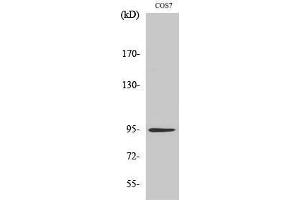 Western Blotting (WB) image for anti-Insulin Receptor (INSR) (Ser59) antibody (ABIN3175669) (Insulin Receptor 抗体  (Ser59))