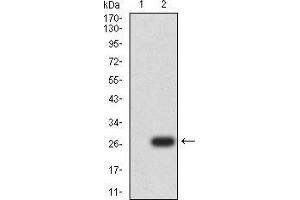 Western Blotting (WB) image for anti-Uncoupling Protein 3 (Mitochondrial, Proton Carrier) (UCP3) (AA 1-113), (AA 217-312) antibody (ABIN5871957) (UCP3 抗体  (AA 1-113, AA 217-312))