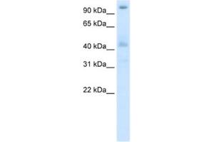 Western Blotting (WB) image for anti-Pogo Transposable Element with ZNF Domain (POGZ) antibody (ABIN2461864) (POGZ 抗体)