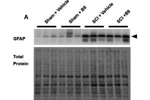 Western blot showing a band at the molecular weight corresponding to GFAP (cat. (GFAP 抗体  (AA 411-422))