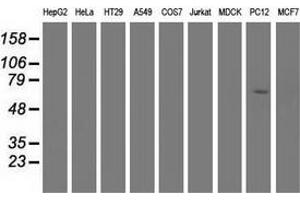Western blot analysis of extracts (35 µg) from 9 different cell lines by using anti-EPM2AIP1 monoclonal antibody. (EPM2AIP1 抗体)
