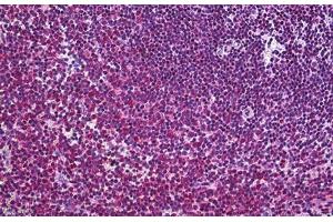 Human Spleen: Formalin-Fixed, Paraffin-Embedded (FFPE) (FLIP 抗体  (AA 178-277))