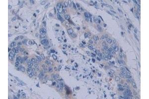 Immunohistochemistry (IHC) image for anti-Tyrosyl-tRNA Synthetase (Yars) (AA 2-528) antibody (ABIN7443434)