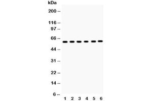 Western blot testing of EAAT2 antibody and Lane 1:  rat brain (SLC1A2 抗体  (AA 461-574))