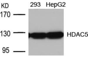 Image no. 1 for anti-Histone Deacetylase 5 (HDAC5) (AA 496-500) antibody (ABIN197340) (HDAC5 抗体  (AA 496-500))