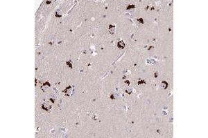 Immunohistochemical staining of human lateral ventricle with LYPD6 polyclonal antibody  shows strong cytoplasmic positivity in neuronal cells at 1:10-1:20 dilution.