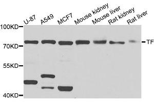 Western blot analysis of extracts of various cell lines, using TF antibody. (Transferrin 抗体)