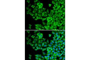 Immunofluorescence analysis of A549 cells using HCK antibody (ABIN5971109). (HCK 抗体)