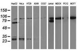 Image no. 6 for anti-Catenin (Cadherin-Associated Protein), beta 1, 88kDa (CTNNB1) antibody (ABIN1496890) (CTNNB1 抗体)