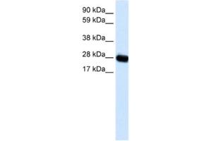 Western Blotting (WB) image for anti-Caveolin 3 (CAV3) antibody (ABIN2463712)