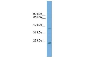 WB Suggested Anti-GSTM1 Antibody Titration:  0. (GSTM1 抗体  (C-Term))