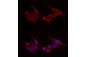 Immunofluorescence (IF) image for anti-Cortactin (CTTN) (AA 214-513) antibody (ABIN6139243)