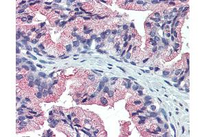Anti-TM9SF3 antibody IHC of prostate, human. (TM9SF3 抗体  (Internal Region))