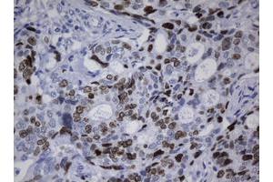Image no. 2 for anti-Antigen Identified By Monoclonal Antibody Ki-67 (MKI67) (AA 1160-1493) antibody (ABIN1490856) (Ki-67 抗体  (AA 1160-1493))