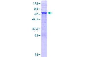Image no. 1 for PHD Finger Protein 20-Like 1 (PHF20L1) (AA 1-285) protein (GST tag) (ABIN1314890) (PHF20L1 Protein (AA 1-285) (GST tag))
