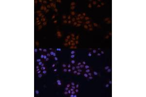 Immunofluorescence analysis of HeLa cells using GTF2I antibody (ABIN6129629, ABIN6141510, ABIN6141512 and ABIN6216068) at dilution of 1:100. (GTF2I 抗体  (AA 600-810))
