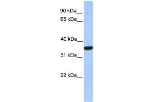 WB Suggested Anti-MOGAT1 Antibody Titration:  0. (MOGAT1 抗体  (C-Term))