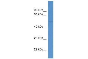 Western Blot showing Fkrp antibody used at a concentration of 1. (FKRP 抗体  (C-Term))