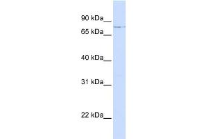 WB Suggested Anti-LCP1 Antibody Titration: 0. (LCP1 抗体  (N-Term))