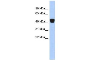 TXNDC4 antibody used at 1 ug/ml to detect target protein. (ERP44 抗体)