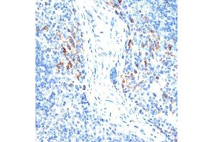 Immunohistochemistry (IHC) image for anti-Matrix Metallopeptidase 9 (Gelatinase B, 92kDa Gelatinase, 92kDa Type IV Collagenase) (MMP9) (AA 538-707) antibody (ABIN6143920)