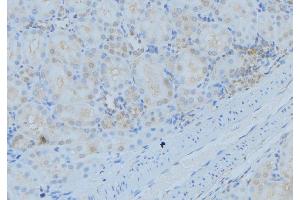 ABIN6279339 at 1/100 staining Mouse kidney tissue by IHC-P. (DYNC1I2 抗体  (N-Term))